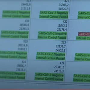 27-minute detection of SARS-CoV-2 STEP 4 Plate-read-out